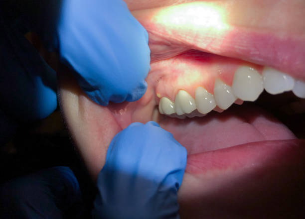 Best Walk-In Emergency Dentist in Lewisville, TX