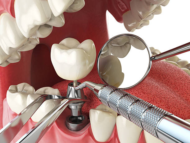 Best Emergency Treatment for Toothache in Lewisville, TX