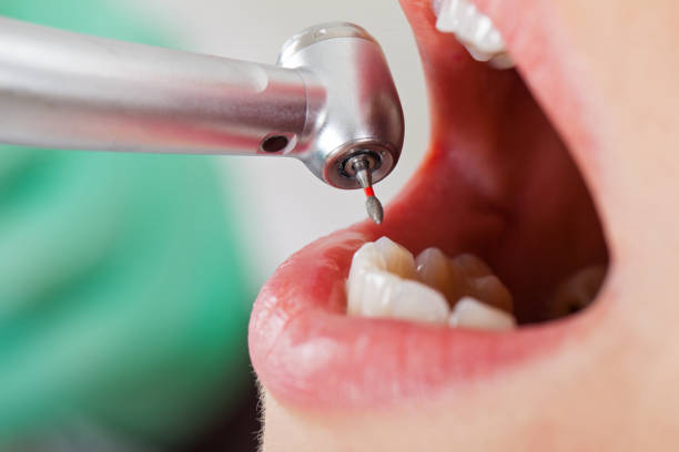 Best Emergency Dental Care for Trauma or Injury in Lewisville, TX